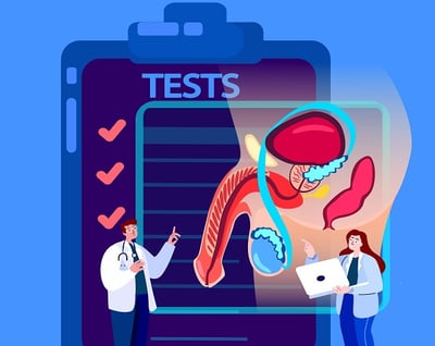 Vektor-Illustration von Hodenkrebs-Diagnostik