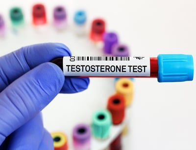 Testosteron-Blutprobe