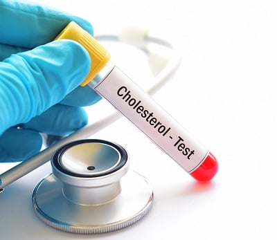  Blutprobe für Cholesterintest