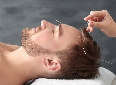 Ein Mann bei einer Akupunkturbehandlung