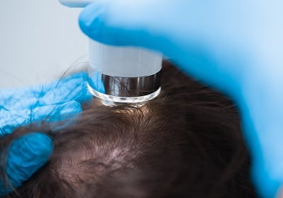 Ein Trichologe führt eine Trichoskopie durch, um Haarausfall zu diagnostizieren.