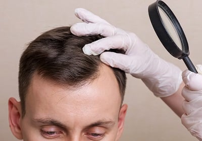 Ein Arzt führt eine körperliche Untersuchung der Kopfhaut eines Mannes durch.