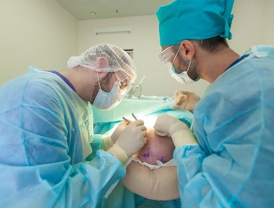 Chirurgen, die Haartransplantationen durchführen.