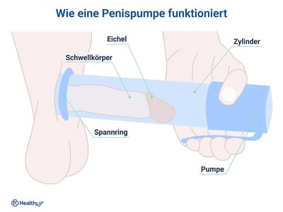 Wie funktioniert eine Penispumpe