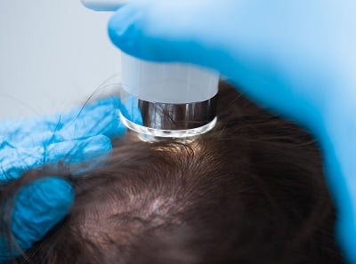 Ein Mann, der sich wegen Haarausfall einer Trichoskopie durch einen Trichologen unterzieht.