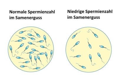 Eine grafische Darstellung der Spermienzahl