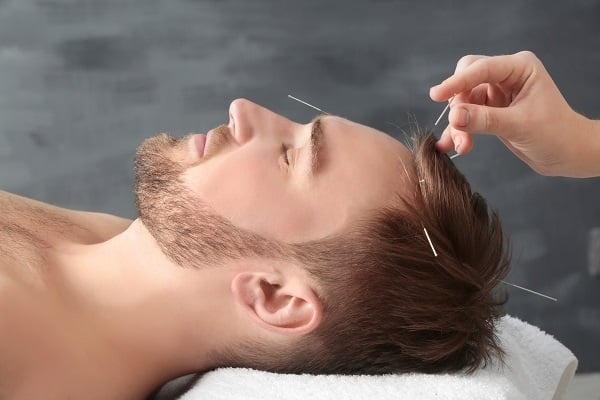  Akupunktur als Mittel gegen Erektionsstörungen